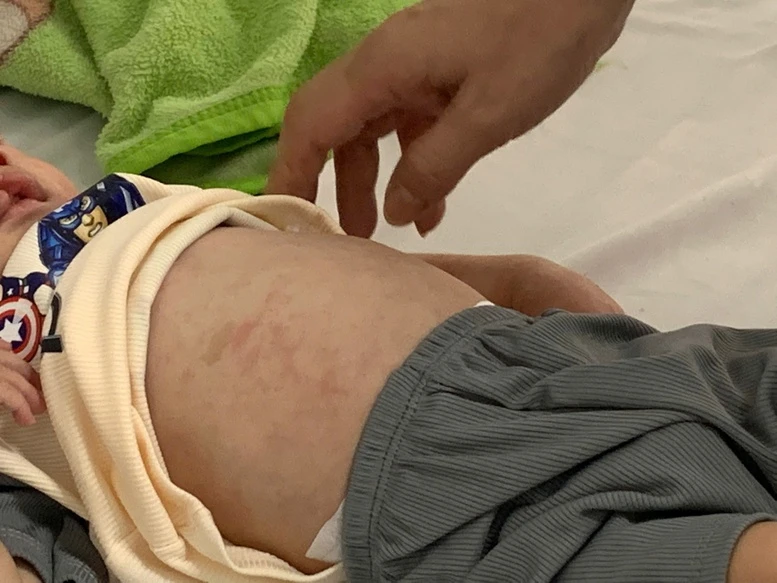Rà soát đối tượng tiêm vaccine sởi - Ảnh 1.