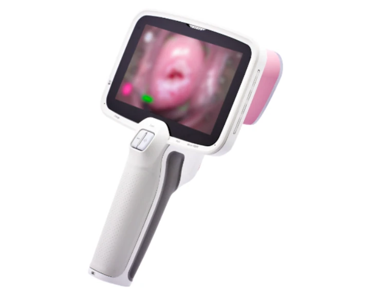 Thiết bị CerviCARE® AI – công cụ sàng lọc ung thư cổ tử cung bằng trí tuệ nhân tạo do NTL Healthcare phát triển.