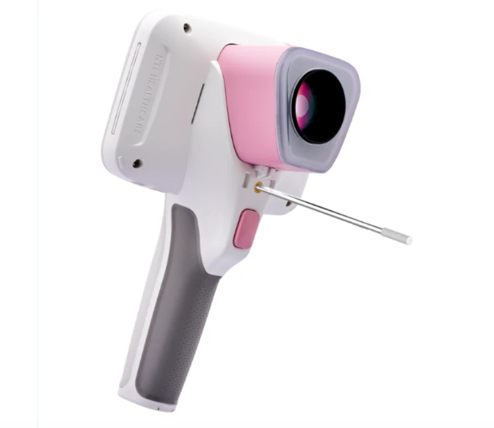 Thiết bị CerviCARE® AI – máy chụp và phân tích hình ảnh cổ tử cung hỗ trợ tầm soát ung thư sớm bằng trí tuệ nhân tạo.