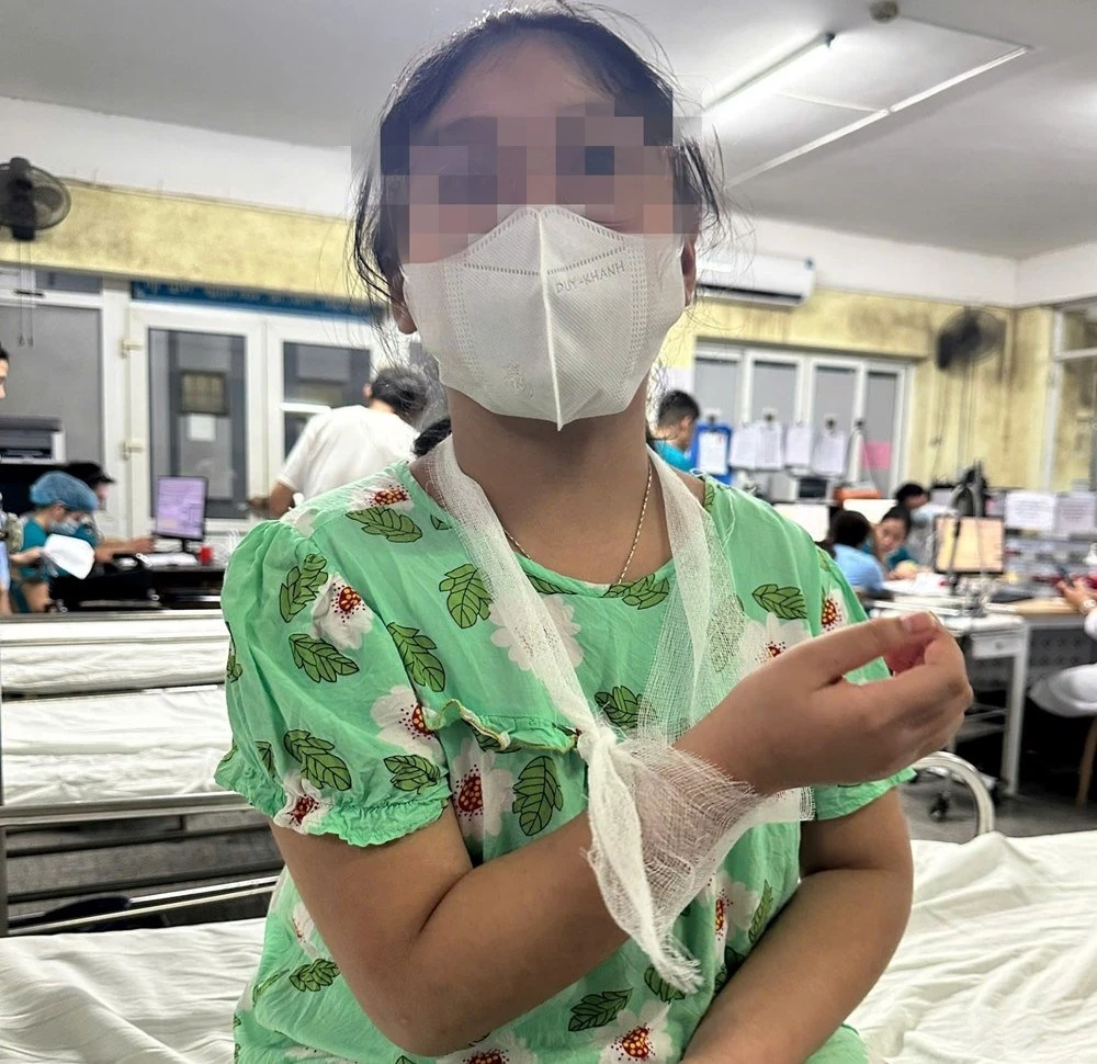 Cháu T.L.A.T thời điểm vào nhập viện tại Bệnh viện Trường Đại học Y Dược Huế